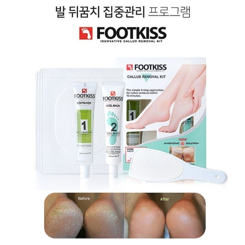바렌 발각질전문 홈 4종세트 발뒷굼치